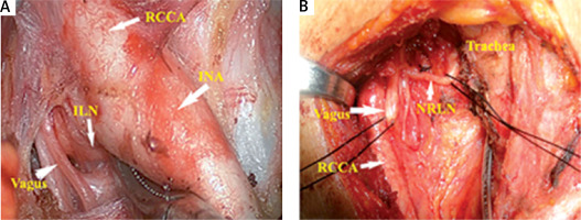 https://www.archivesofmedicalscience.com/f/fulltexts/114895/AMS-20-3-114895-g005_min.jpg