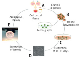 https://www.archivesofmedicalscience.com/f/fulltexts/115576/AMS-20-3-115576-g001_min.jpg