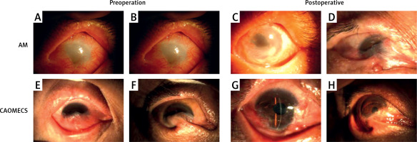 https://www.archivesofmedicalscience.com/f/fulltexts/115576/AMS-20-3-115576-g004_min.jpg