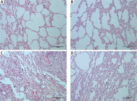 https://www.archivesofmedicalscience.com/f/fulltexts/116561/AMS-20-3-116561-g002_min.jpg