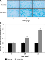 https://www.archivesofmedicalscience.com/f/fulltexts/127271/AMS-20-6-127271-g002_min.jpg