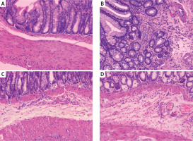 https://www.archivesofmedicalscience.com/f/fulltexts/127587/AMS-20-6-127587-g001_min.jpg