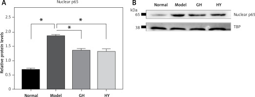 https://www.archivesofmedicalscience.com/f/fulltexts/127587/AMS-20-6-127587-g004_min.jpg