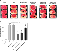 https://www.archivesofmedicalscience.com/f/fulltexts/130649/AMS-20-6-130649-g004_min.jpg