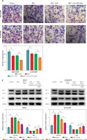 https://www.archivesofmedicalscience.com/f/fulltexts/133038/AMS-20-4-133038-g002a_min.jpg