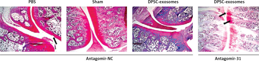 https://www.archivesofmedicalscience.com/f/fulltexts/157032/AMS-20-5-157032-g008_min.jpg