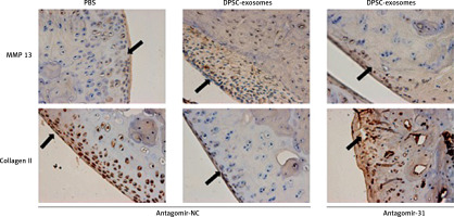 https://www.archivesofmedicalscience.com/f/fulltexts/157032/AMS-20-5-157032-g009_min.jpg