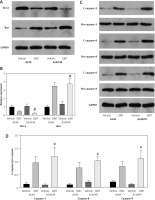 https://www.archivesofmedicalscience.com/f/fulltexts/158533/AMS-20-5-158533-g004_min.jpg