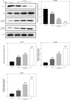 https://www.archivesofmedicalscience.com/f/fulltexts/174578/AMS-20-3-174578-g001d_min.jpg