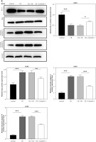 https://www.archivesofmedicalscience.com/f/fulltexts/174578/AMS-20-3-174578-g005b_min.jpg