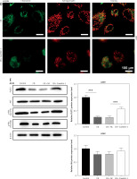 https://www.archivesofmedicalscience.com/f/fulltexts/174578/AMS-20-3-174578-g006b_min.jpg