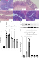 https://www.archivesofmedicalscience.com/f/fulltexts/183465/AMS-20-5-183465-g003_min.jpg