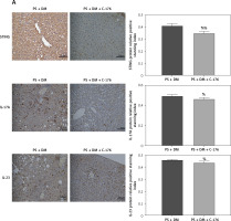 https://www.archivesofmedicalscience.com/f/fulltexts/183672/AMS-20-5-183672-g007_min.jpg