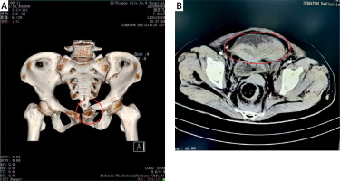 https://www.archivesofmedicalscience.com/f/fulltexts/188204/AMS-20-4-188204-g001_min.jpg