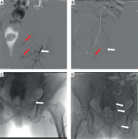 https://www.archivesofmedicalscience.com/f/fulltexts/188204/AMS-20-4-188204-g002_min.jpg