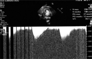 https://www.archivesofmedicalscience.com/f/fulltexts/194435/AMS-20-5-194435-g003_min.jpg