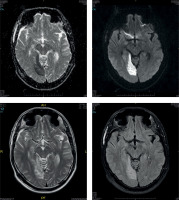 https://www.archivesofmedicalscience.com/f/fulltexts/196379/AMS-20-6-196379-g002_min.jpg