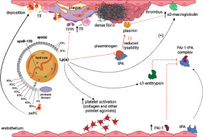 https://www.archivesofmedicalscience.com/f/fulltexts/197357/AMS-20-6-197357-g002_min.jpg